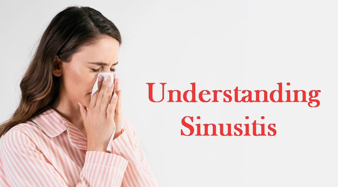 Sinusitis