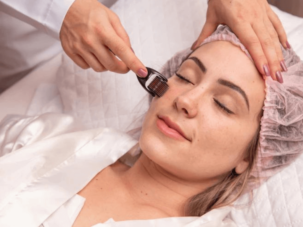 Dermaroller Treatment