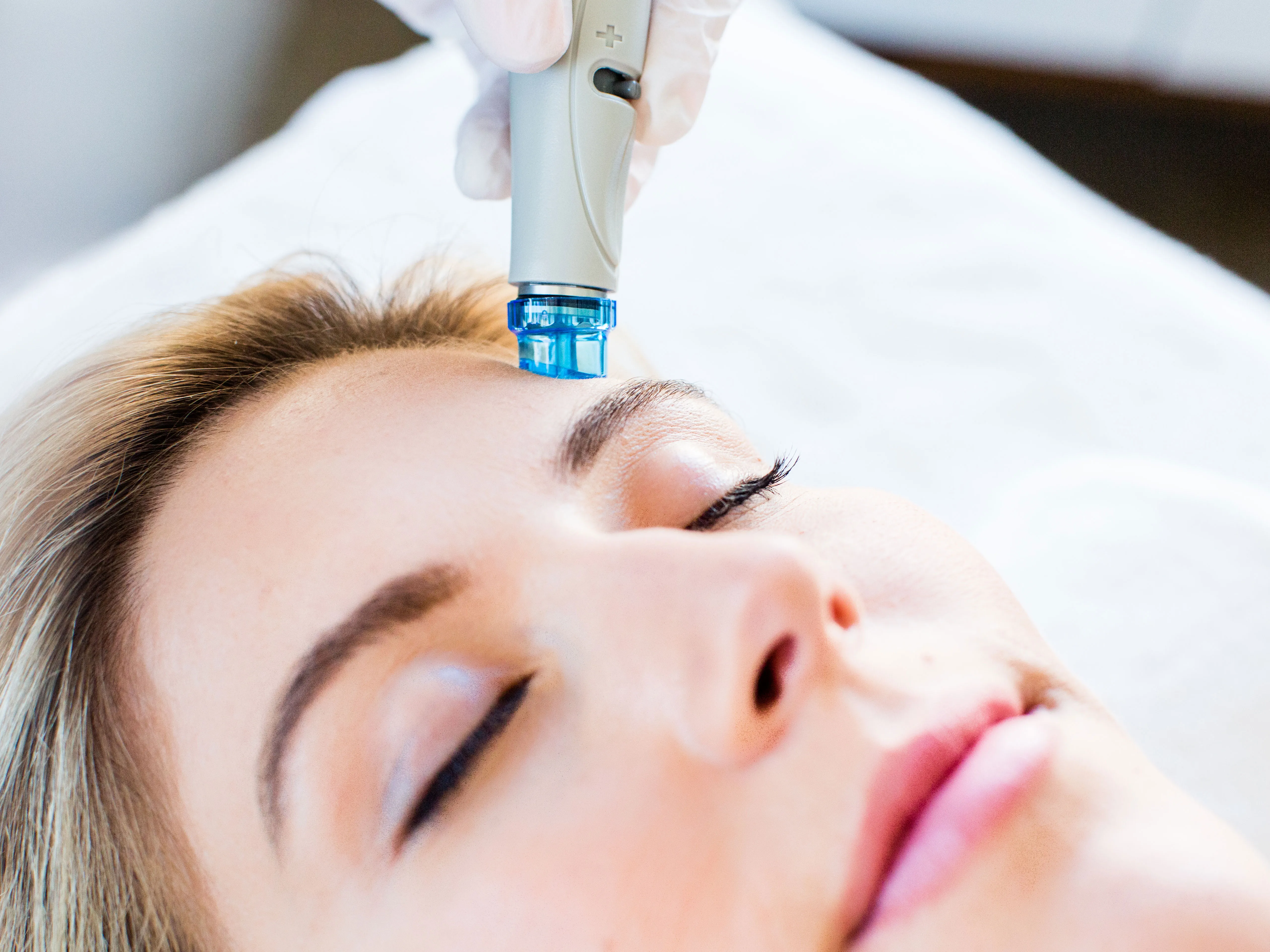 HydraFacial Treatment
