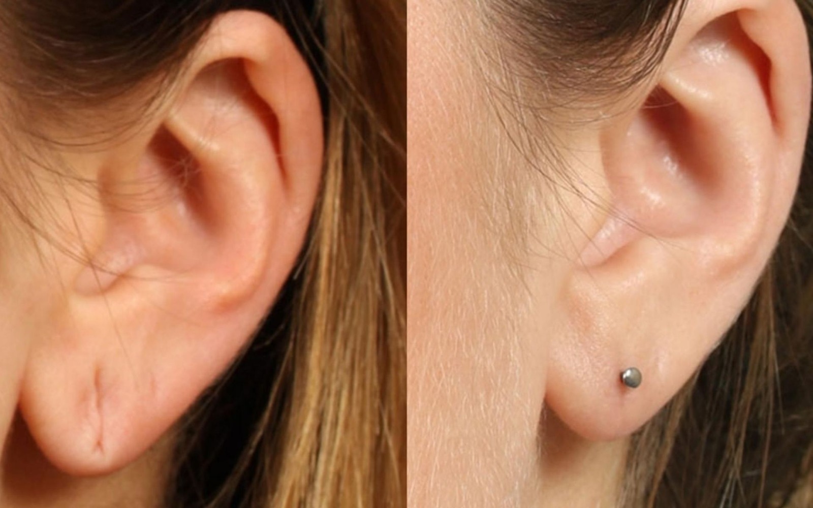 Minor Cosmetic Procedures